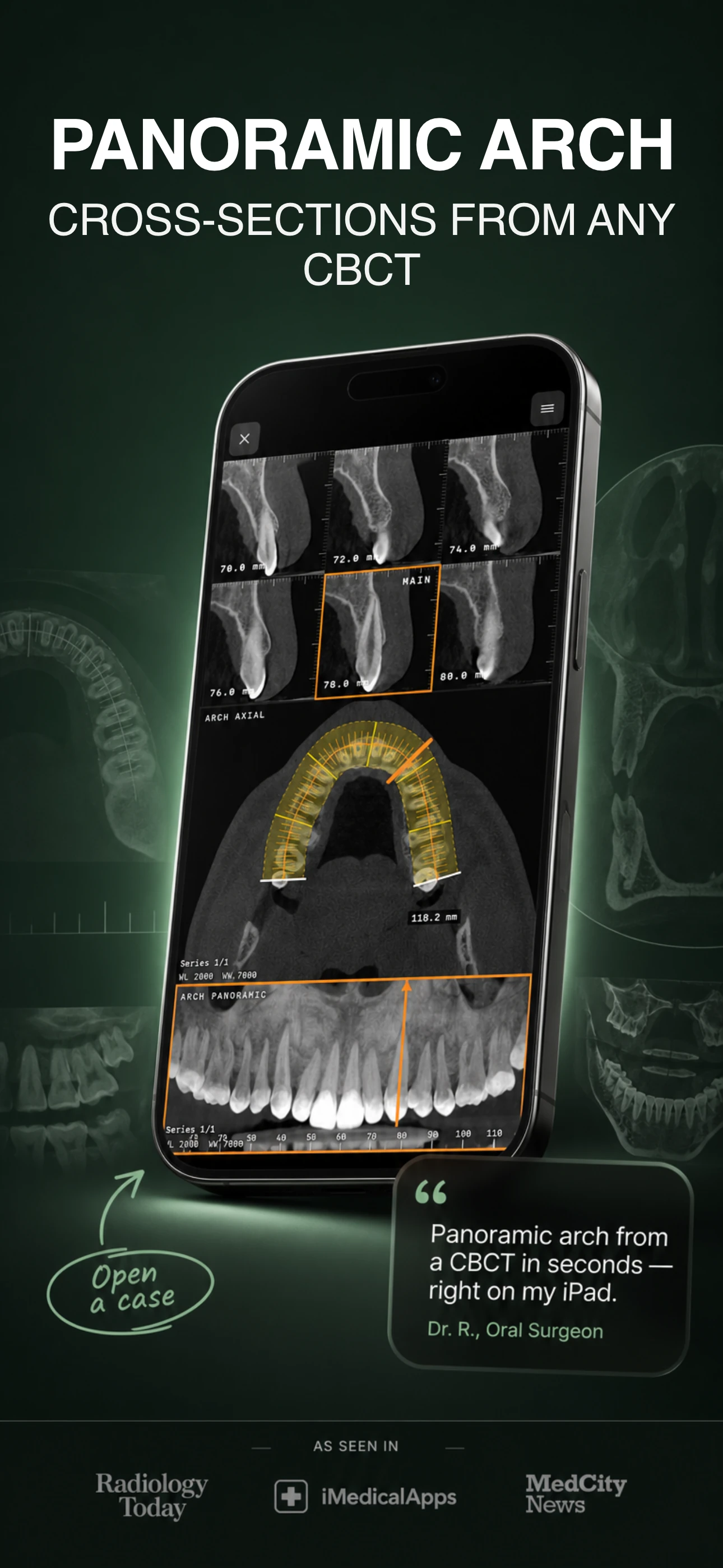 Панорамная реконструкция зубной дуги из CBCT в MedScan